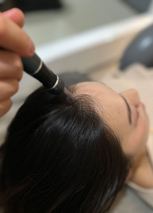 Nano Scalp & Hair Treatments