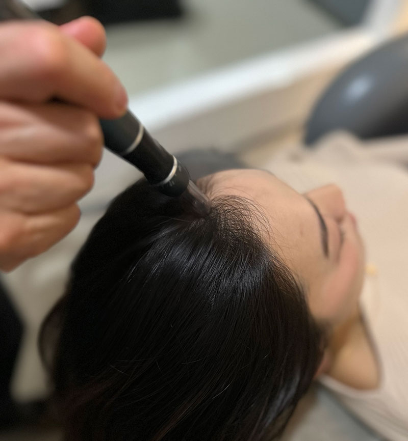 Nano Scalp & Hair Treatments